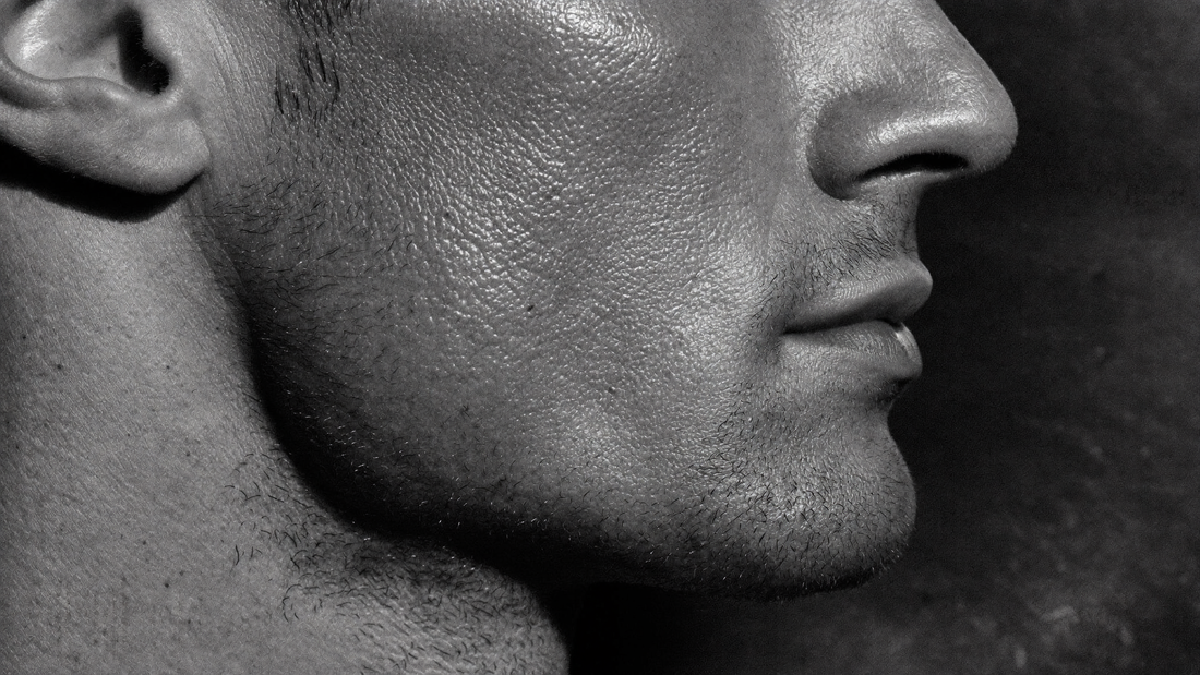 Pelle grassa viso uomo: macro della cute maschile con pori visibili e lucido da sebo in luce drammatica, estetica lab HBSKN