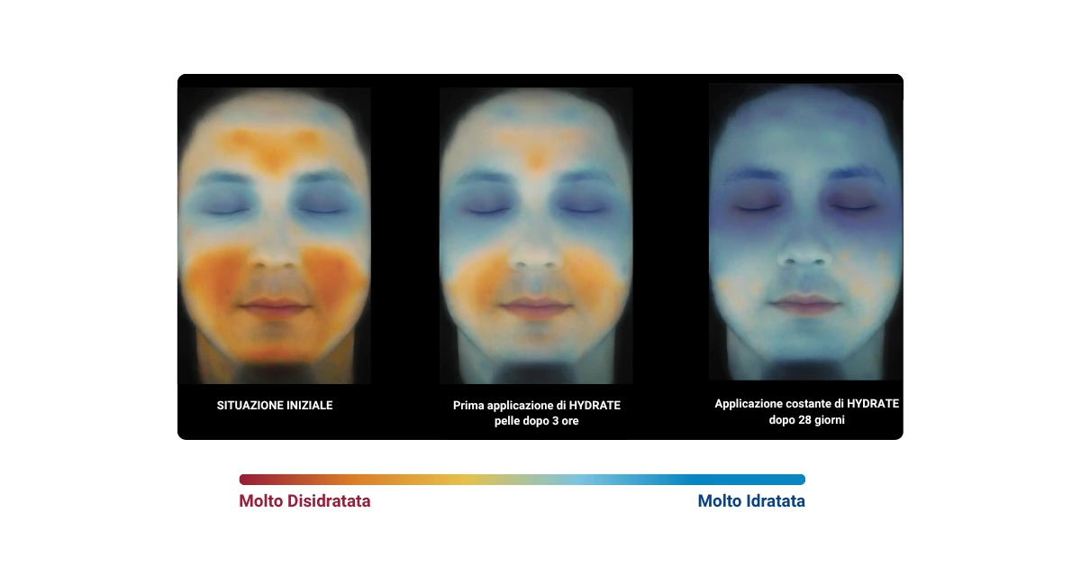 Pentavitin® al 1.5%: idratazione legata 72 ore